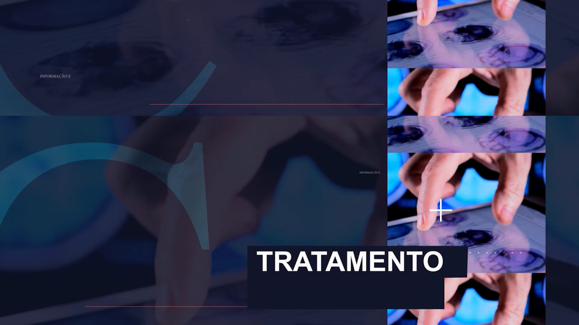 Notícias da Saúde-T03 E137