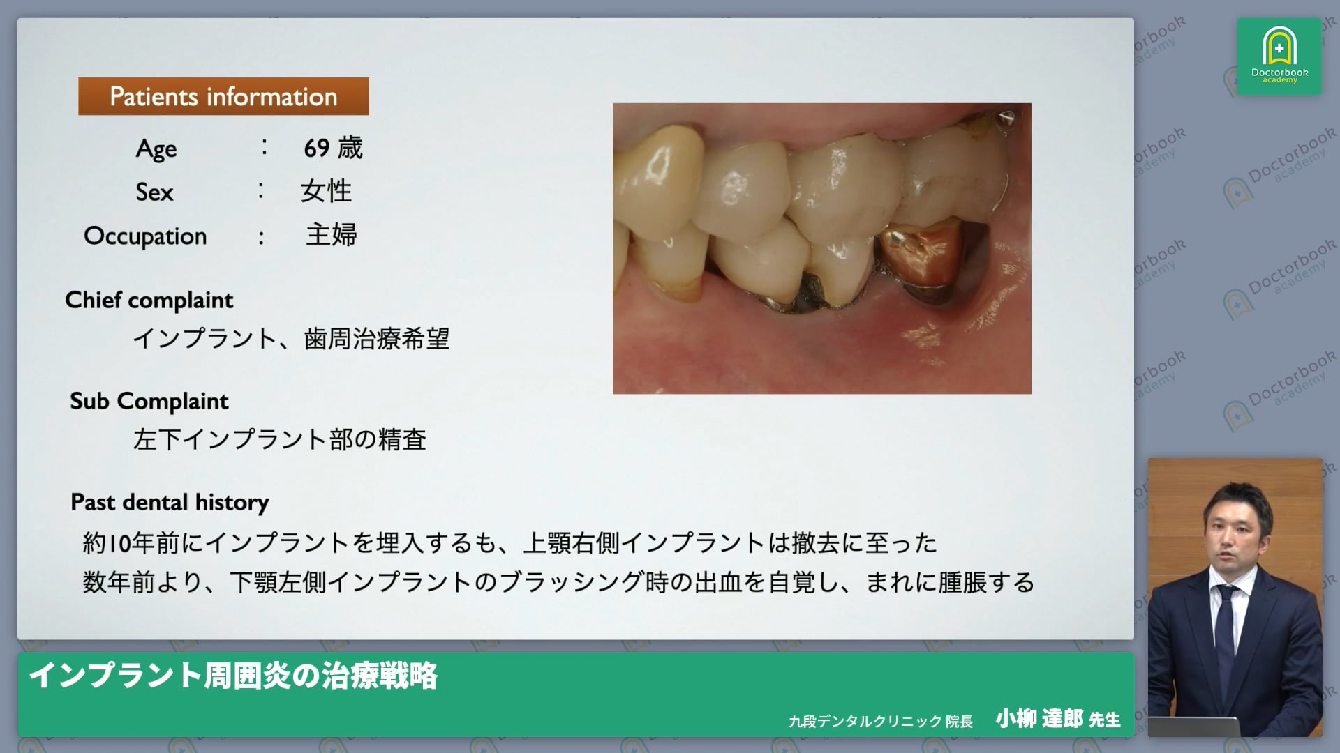 臨床知見録_インプラント周囲炎_非外科でどこまで改善できるか