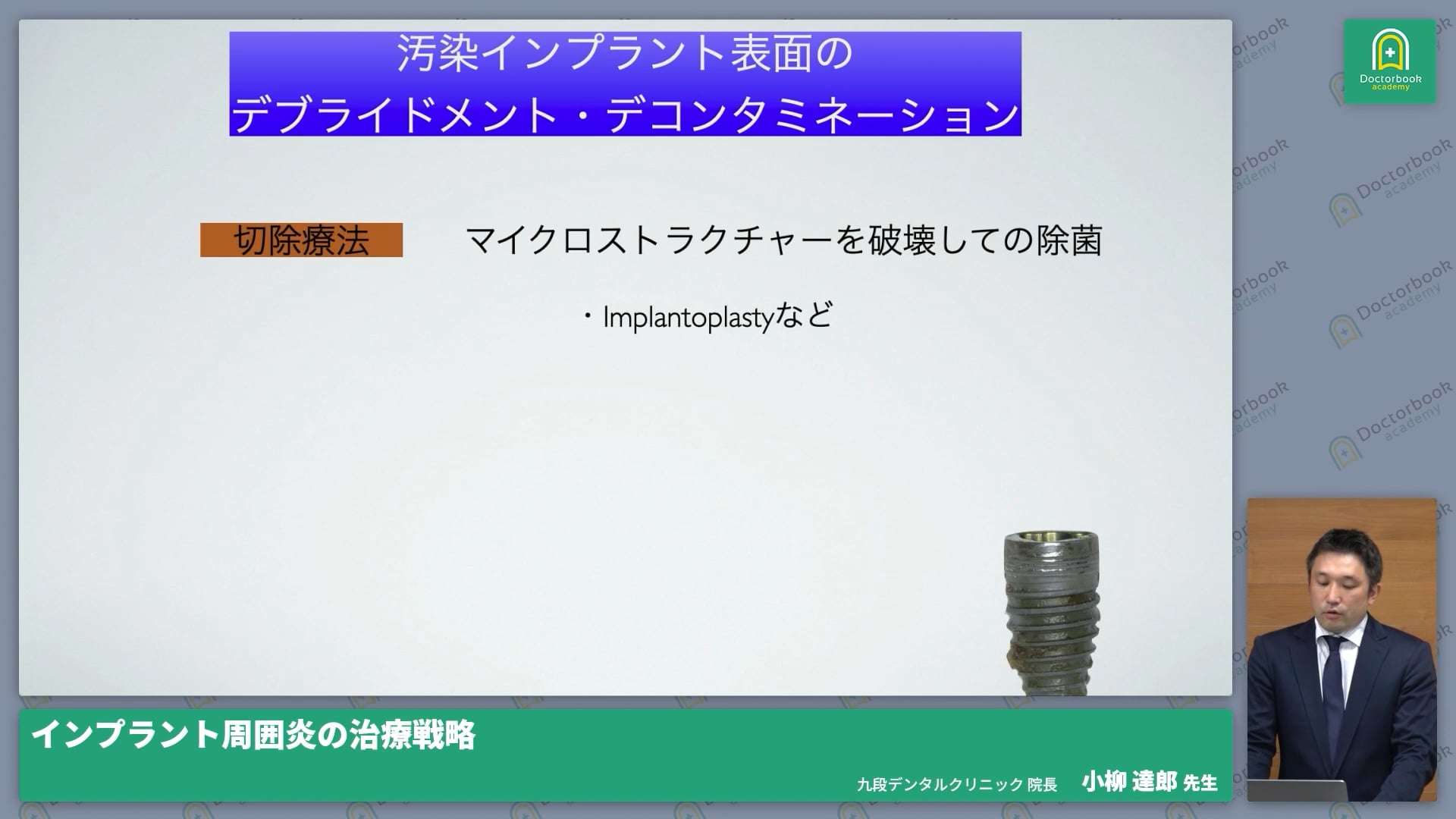 臨床知見録_インプラント周囲炎_切除療法・implantoplastyについて