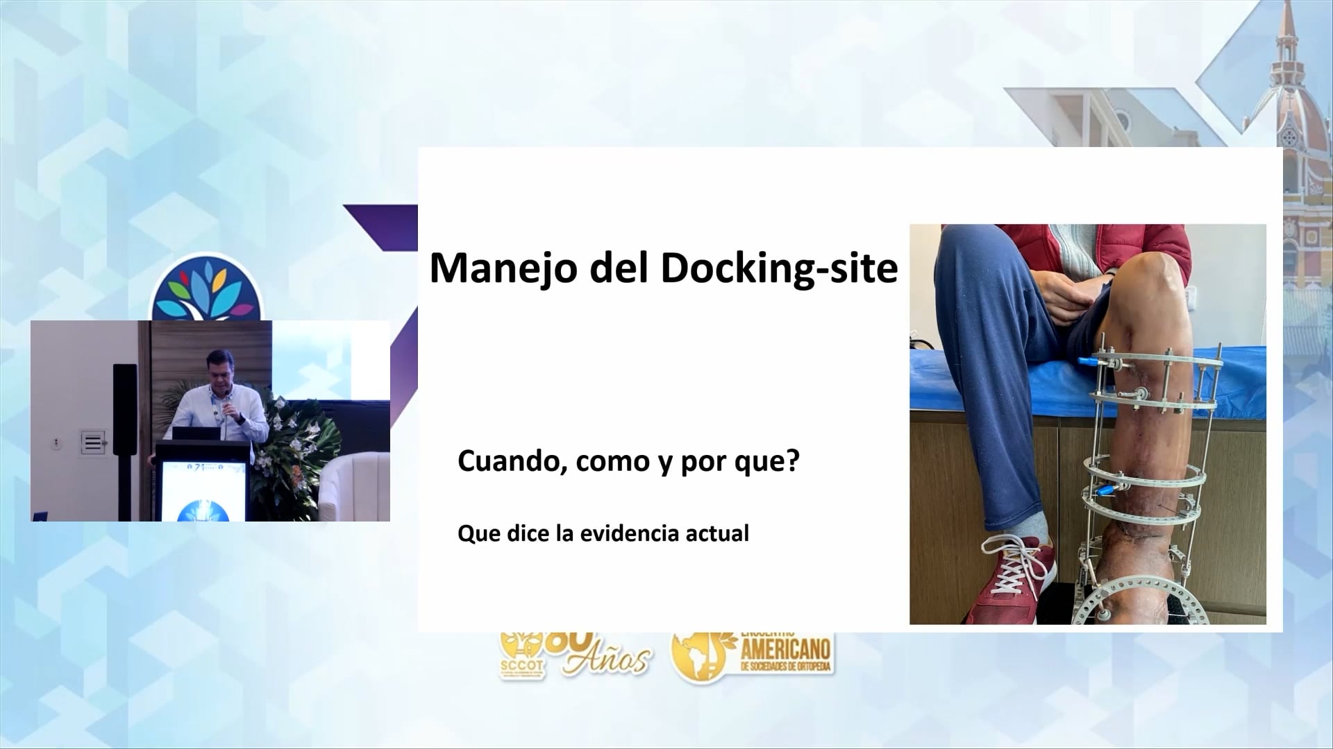 Gestión del Sitio de Acoplamiento en Transporte Óseo