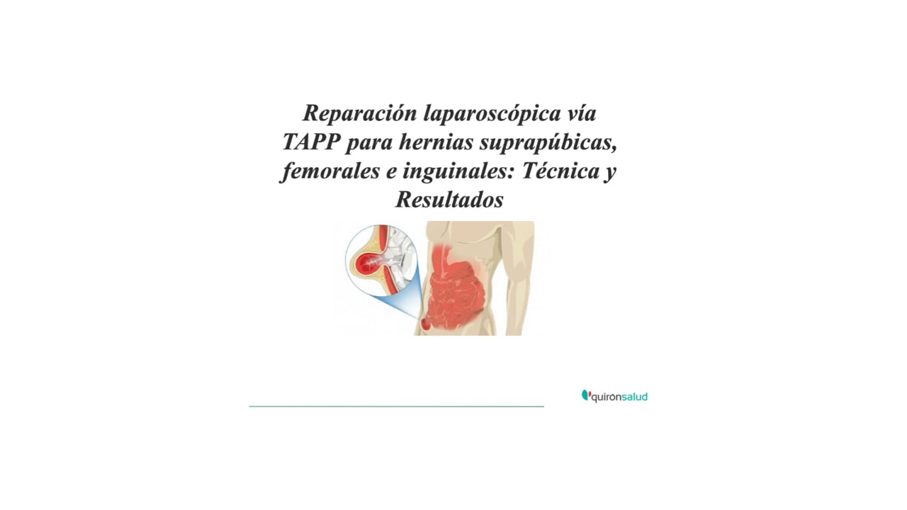 260020. REPARACIÓN LAPAROSCÓPICA VÍA TAPP PARA HERNIAS SUPRAPÚBICAS, FEMORALES E INGUINALES: TÉCNICA Y RESULTADOS