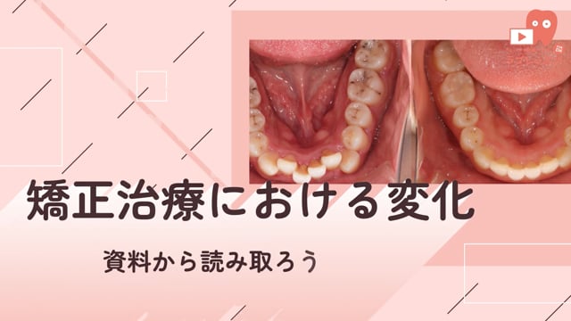 02.矯正治療における変化