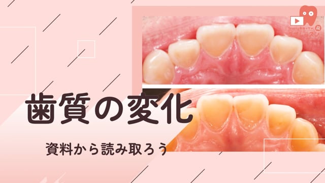 03.歯質の変化