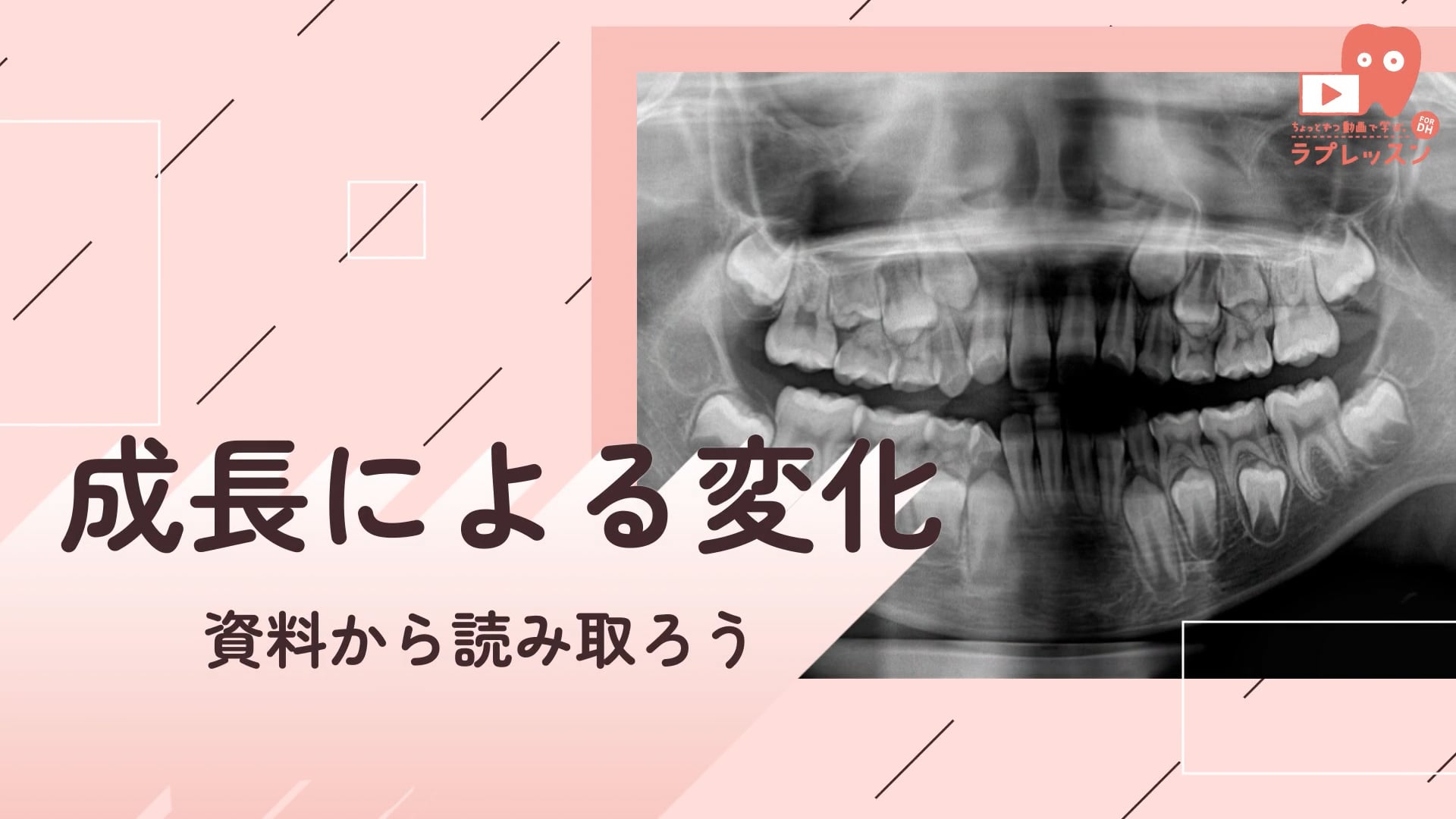 04.成長による変化