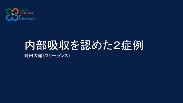 内部吸収を認めた2症例｜時田大輔先生(Archives)