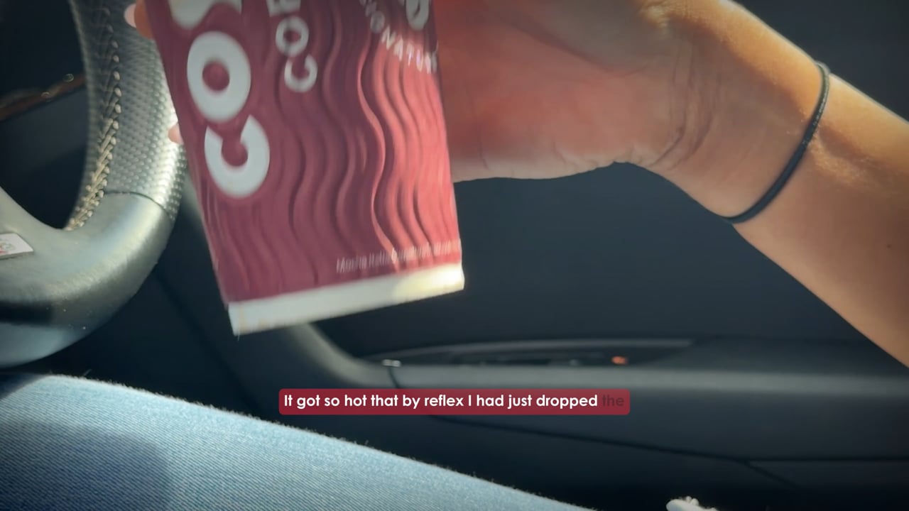 Costa Coffee Burn Injury Claim | Client Story