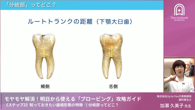 Step2-1 分岐部ってどこ？