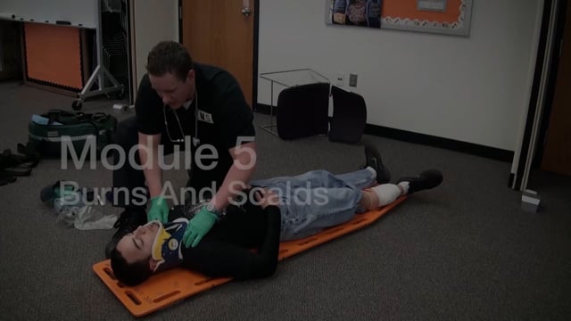 Module 5: Burns and Scalds - Video Thumbnail