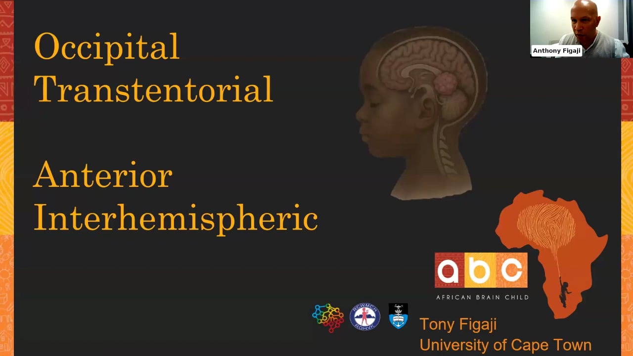 ISPN Webinar 8/26 – Neuro Oncology – Occipital Transtentorial Anterior Interhemispheric