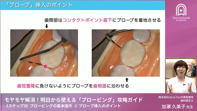 Step3-3 プローブ挿入のポイント