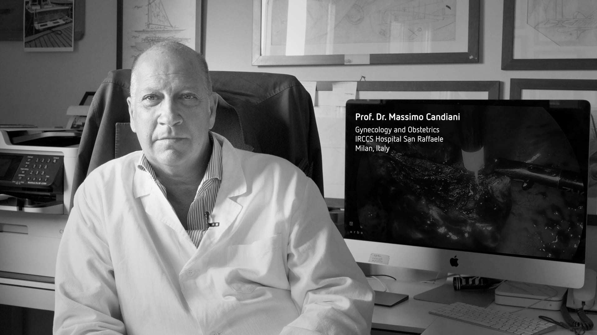 APC Ablation of residual endometrioma - video testimonial by Prof. M Candiani