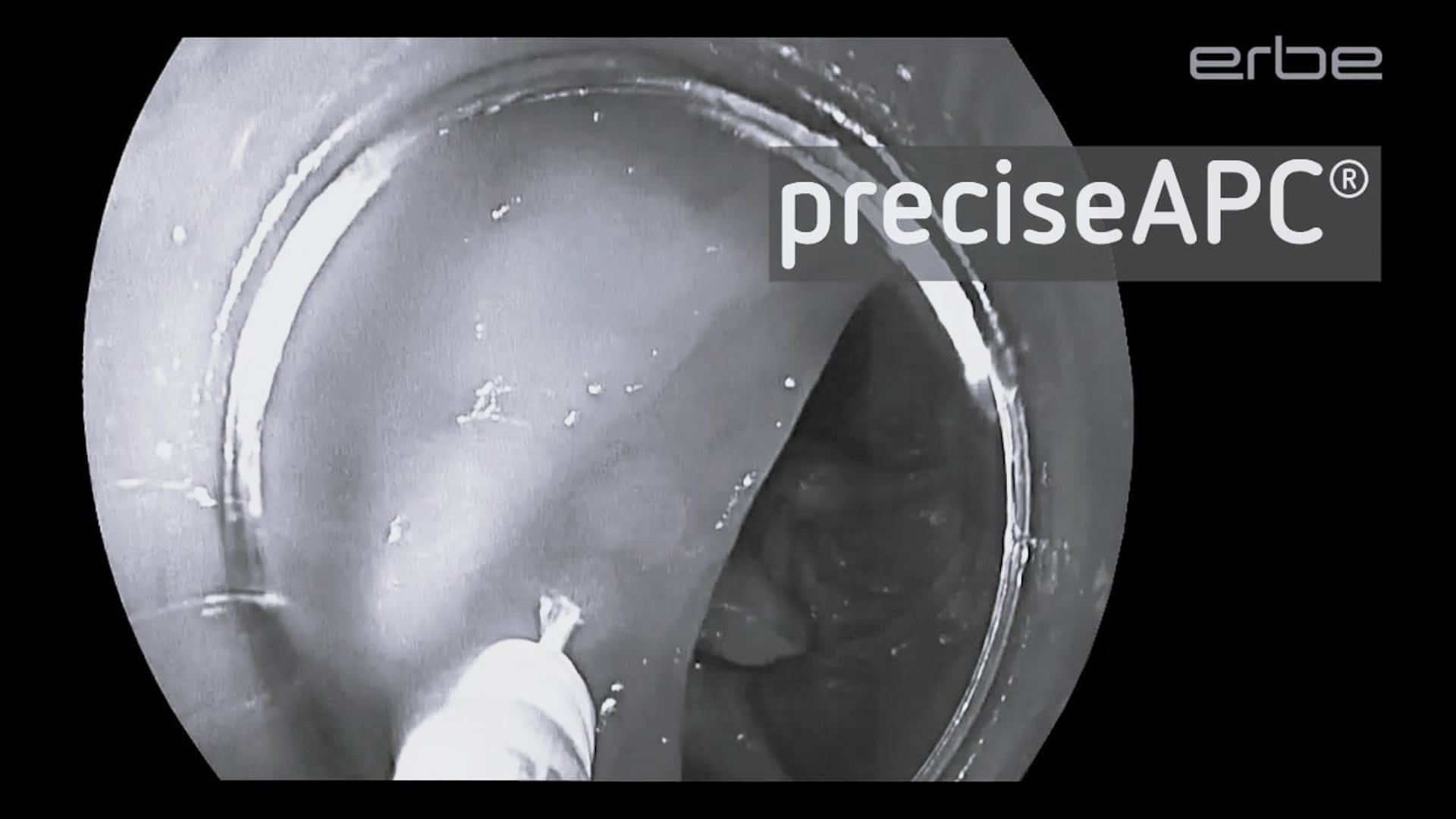 FiAPC plus A probe with preciseAPC E8 - ex-vivo / short clip