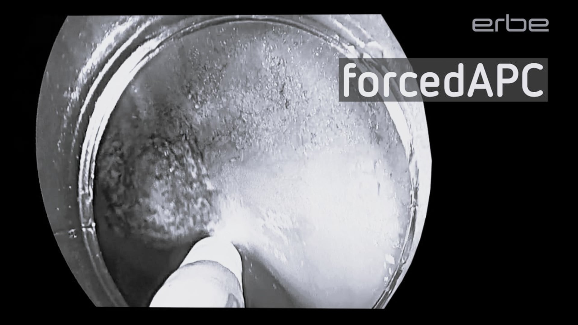 FiAPC plus A probe with forcedAPC E3 - ex-vivo / short clip
