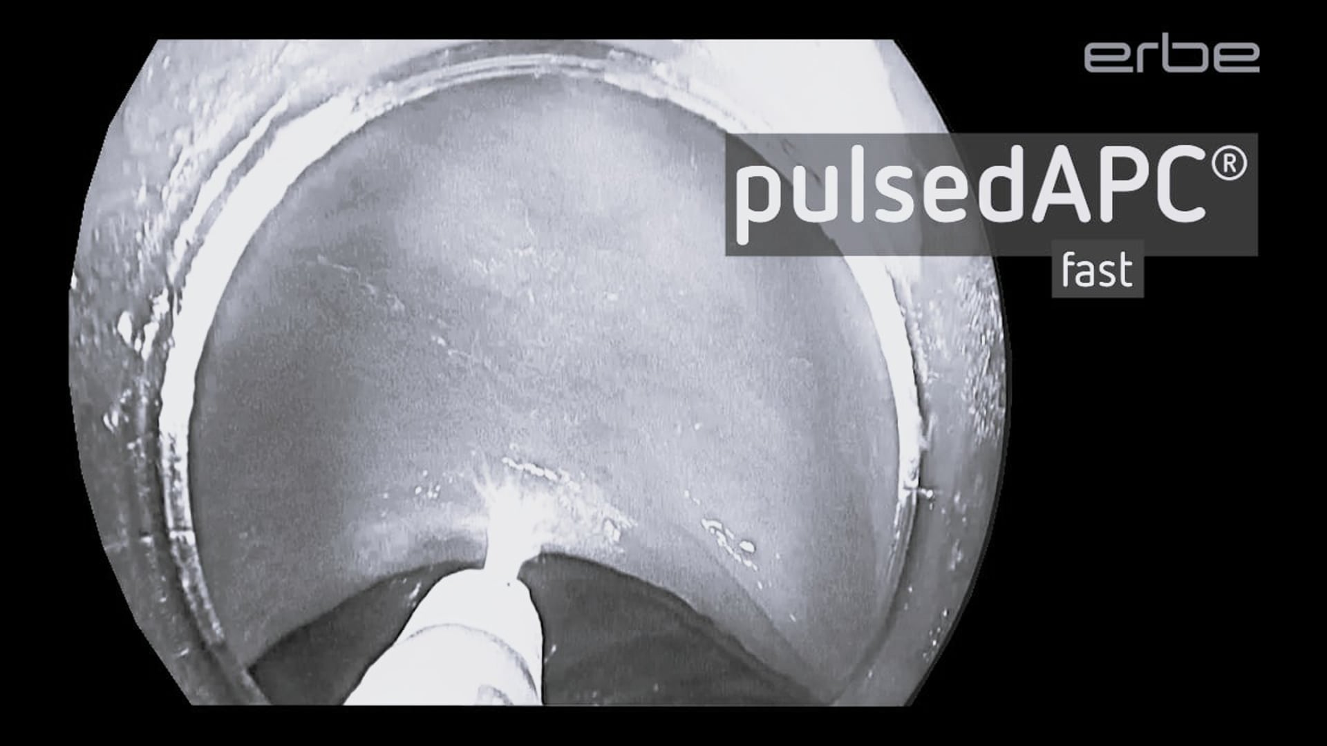 FiAPC plus A probe with pulsedAPC fast and slow - ex-vivo / short clip