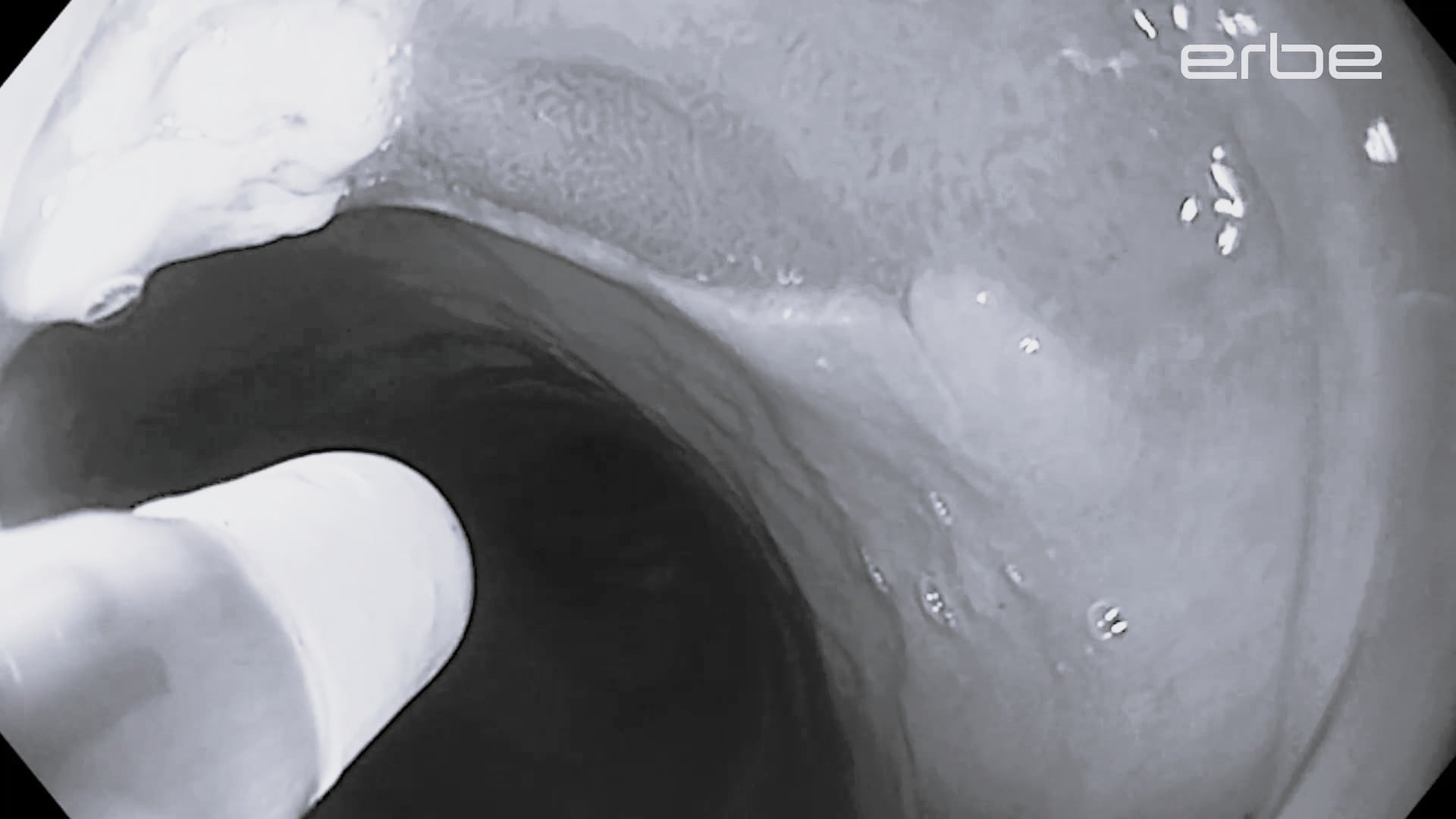 Reduced sticking with FiAPC® plus A probe - short clip