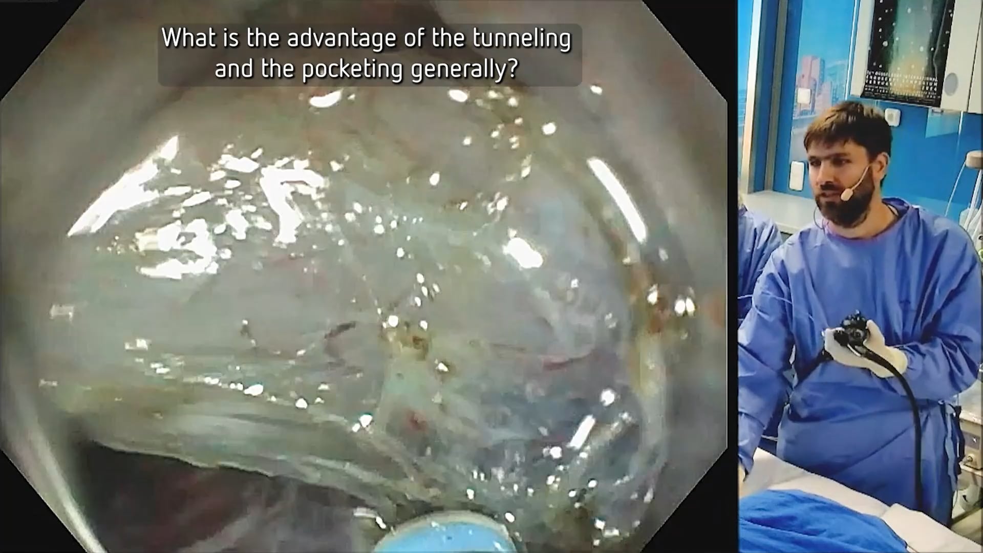 Rectal ESD of a sessile serrated lesion using HYBRIDknife® flex T-Type with VIO® 3 modes and needle-free ERBEJET® 2 injection