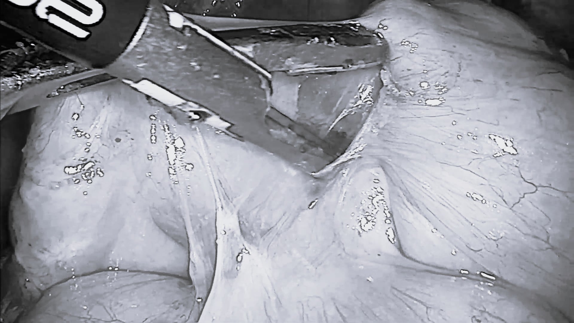 Short-clips-landing-page-TriSect-rap_DIE_Speed-up-your-dissection