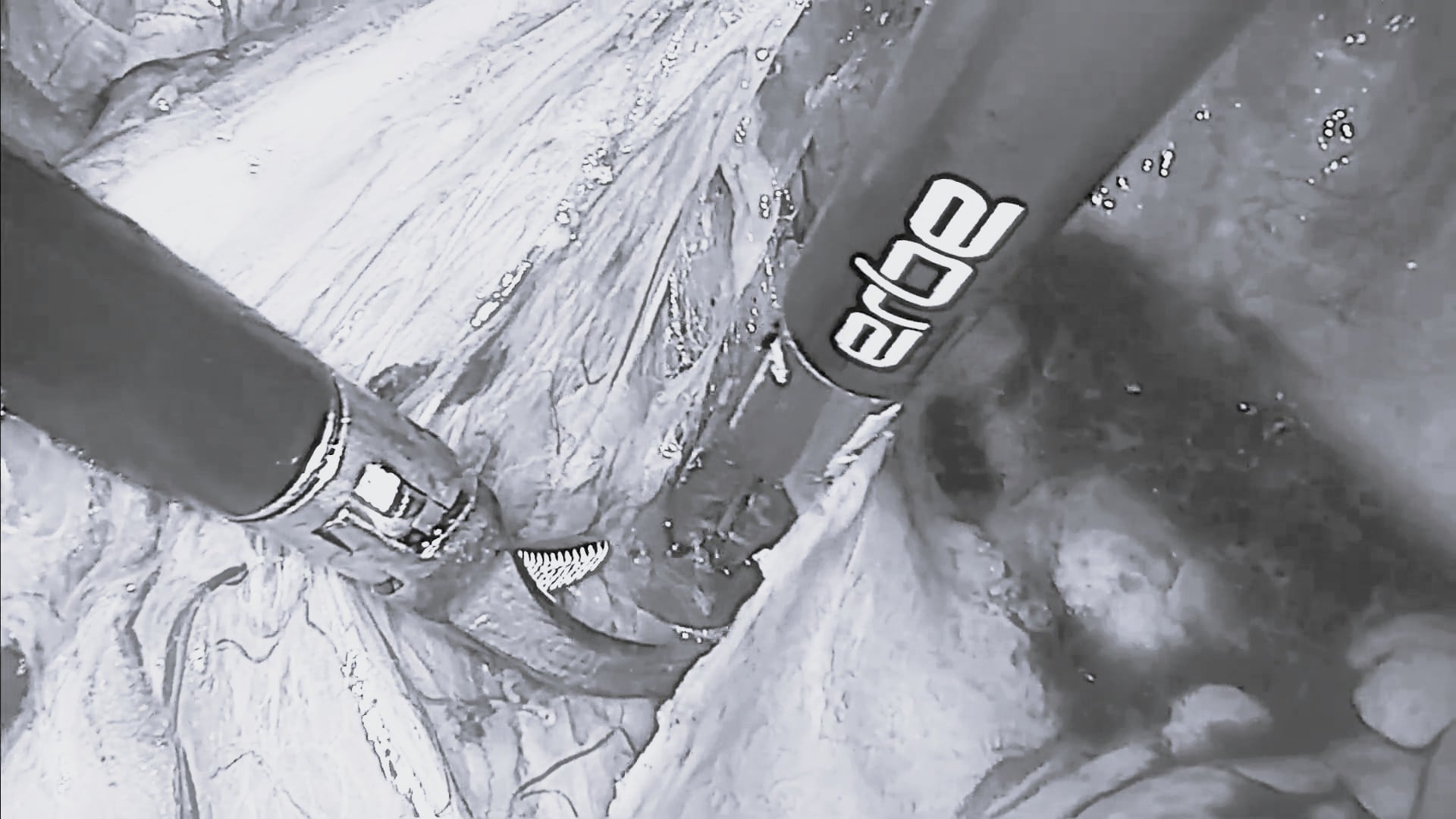 Short-clips-landing-page-TriSect-rap_DIE_Use-variable-hemostasis