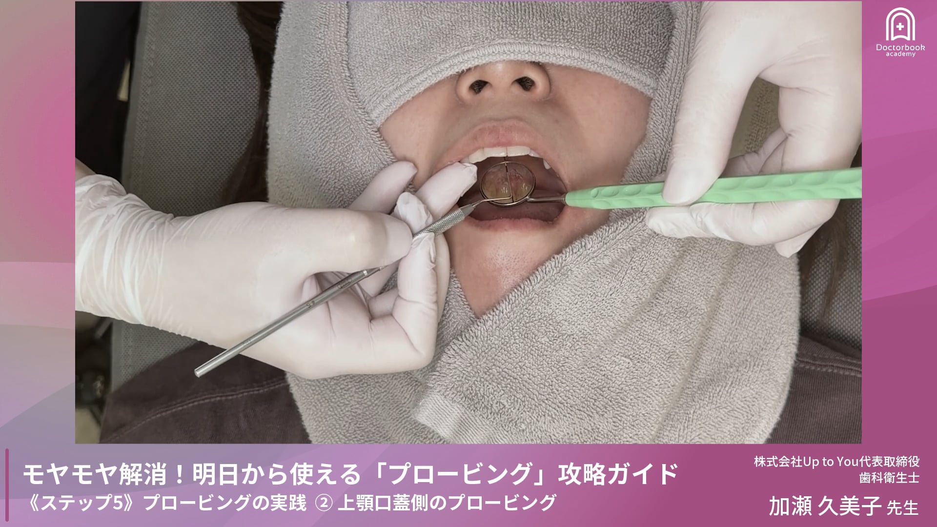 Step5-1 上顎頬側のプロービング