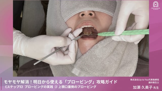Step5-1 上顎頬側のプロービング