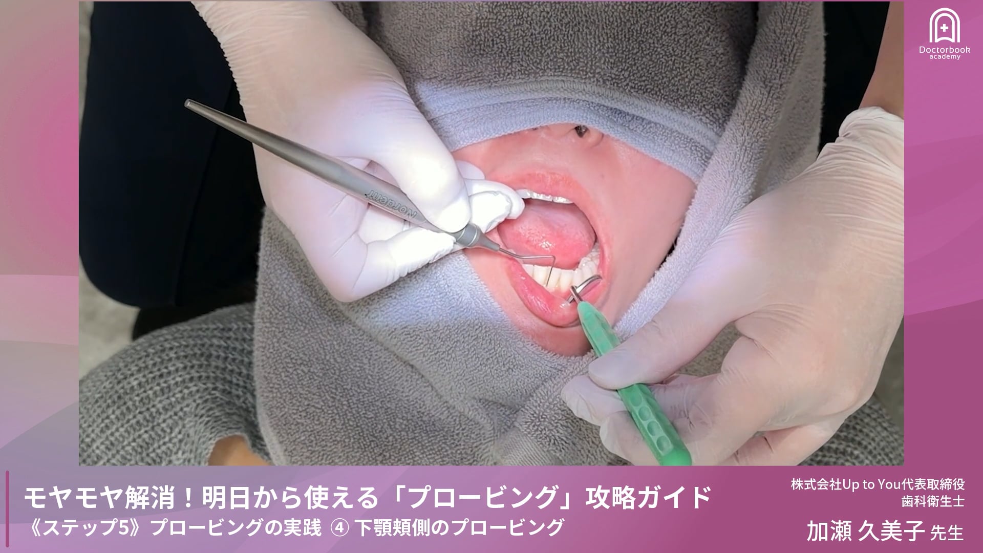 Step5-4 下顎頬側のプロービング