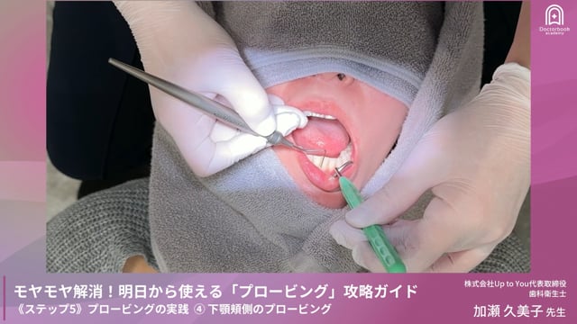 Step5-4 下顎頬側のプロービング