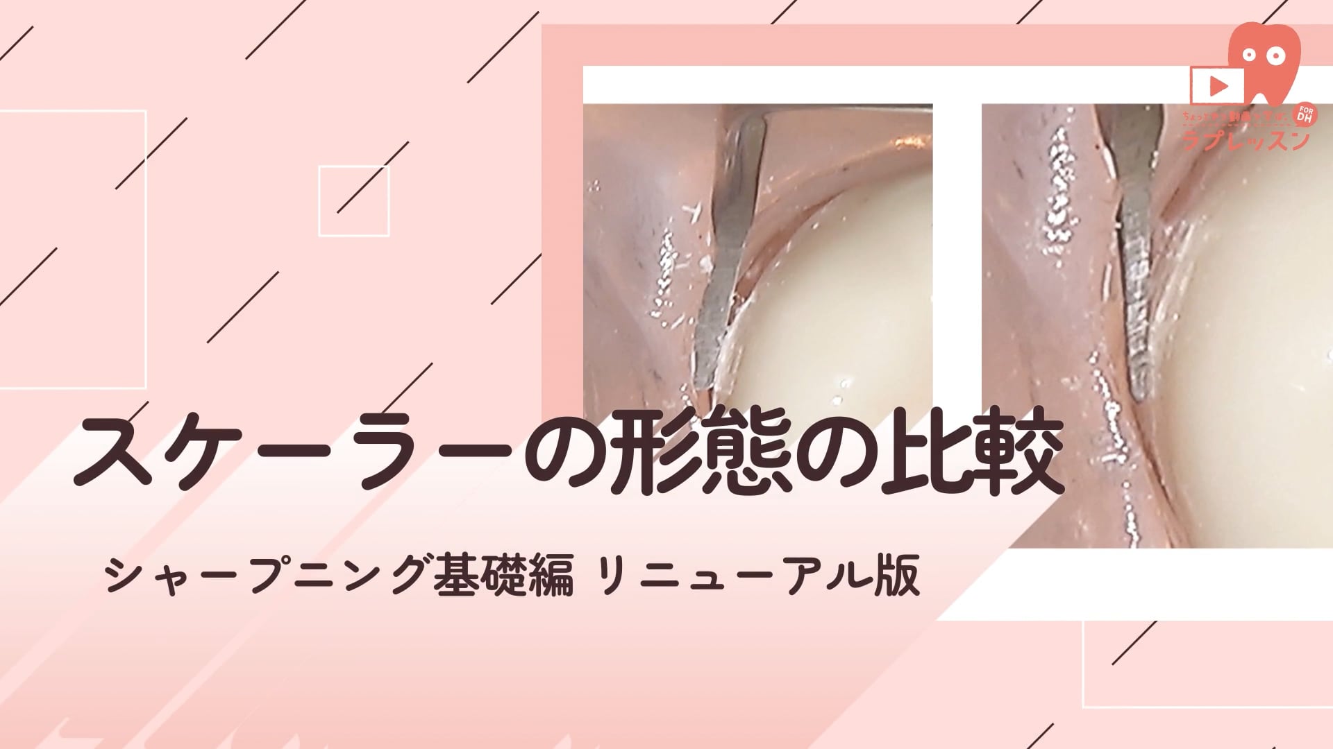 02.スケーラーの形態の比較
