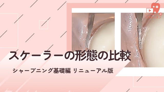 02.スケーラーの形態の比較