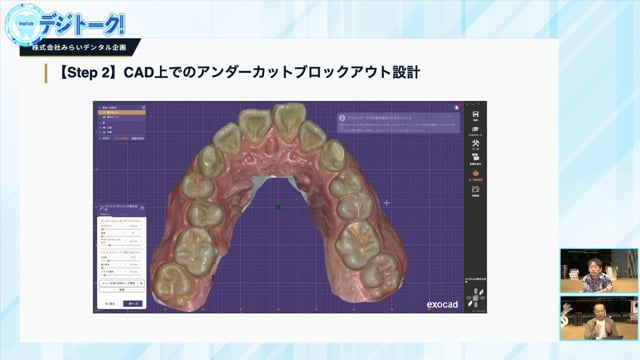 デジタル技工編｜デジトーク！～デジタルデンティストリーの現在と未来を多彩なゲストを呼んで語り合うトーク番組～