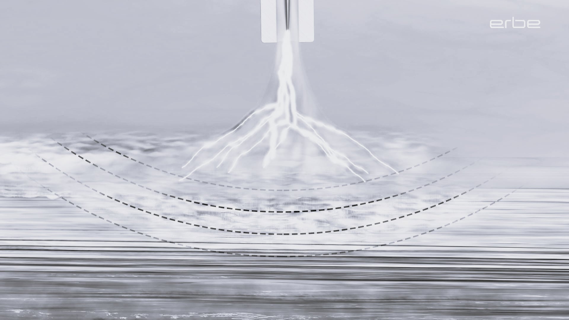 The principle of argon plasma coagulation (APC)