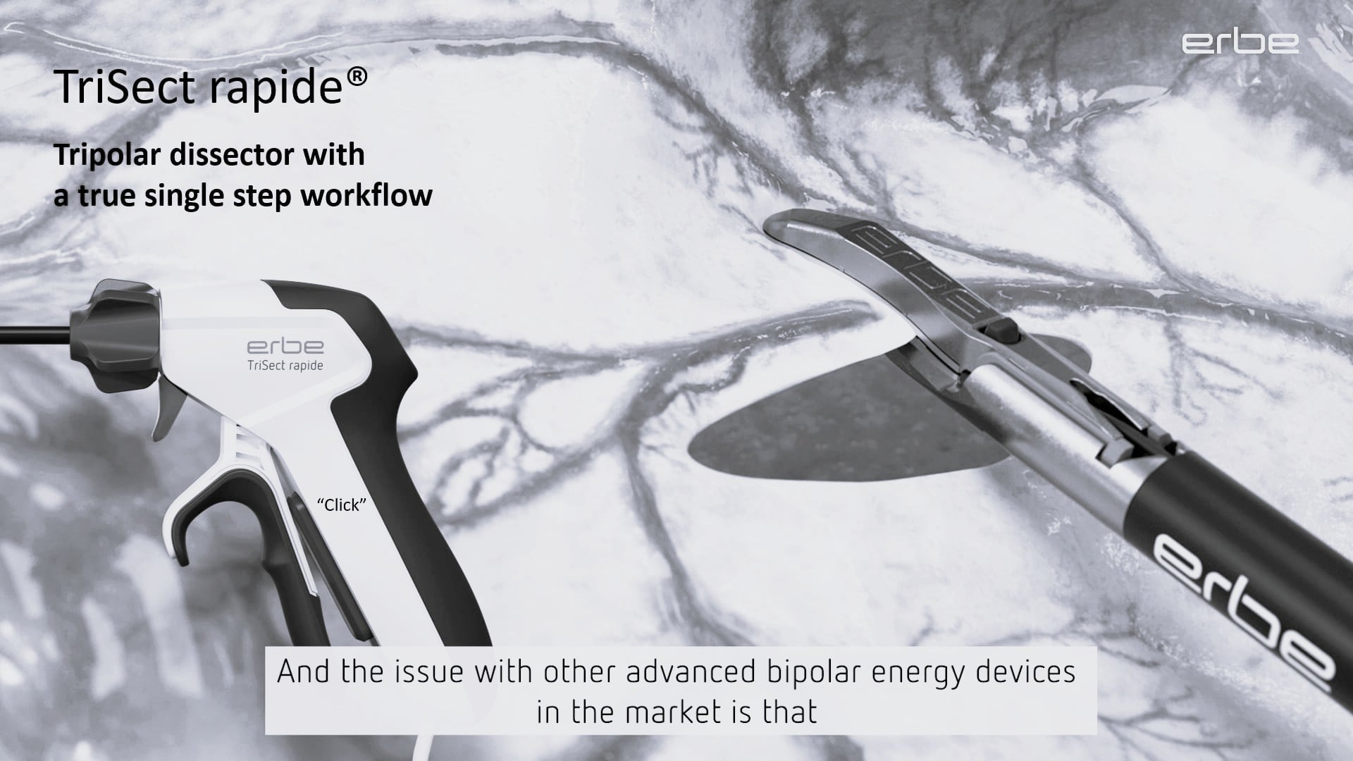 TriSect rapide® - All in one Click. Testimonials of Dr. Sujith Wijerathne, Singapore