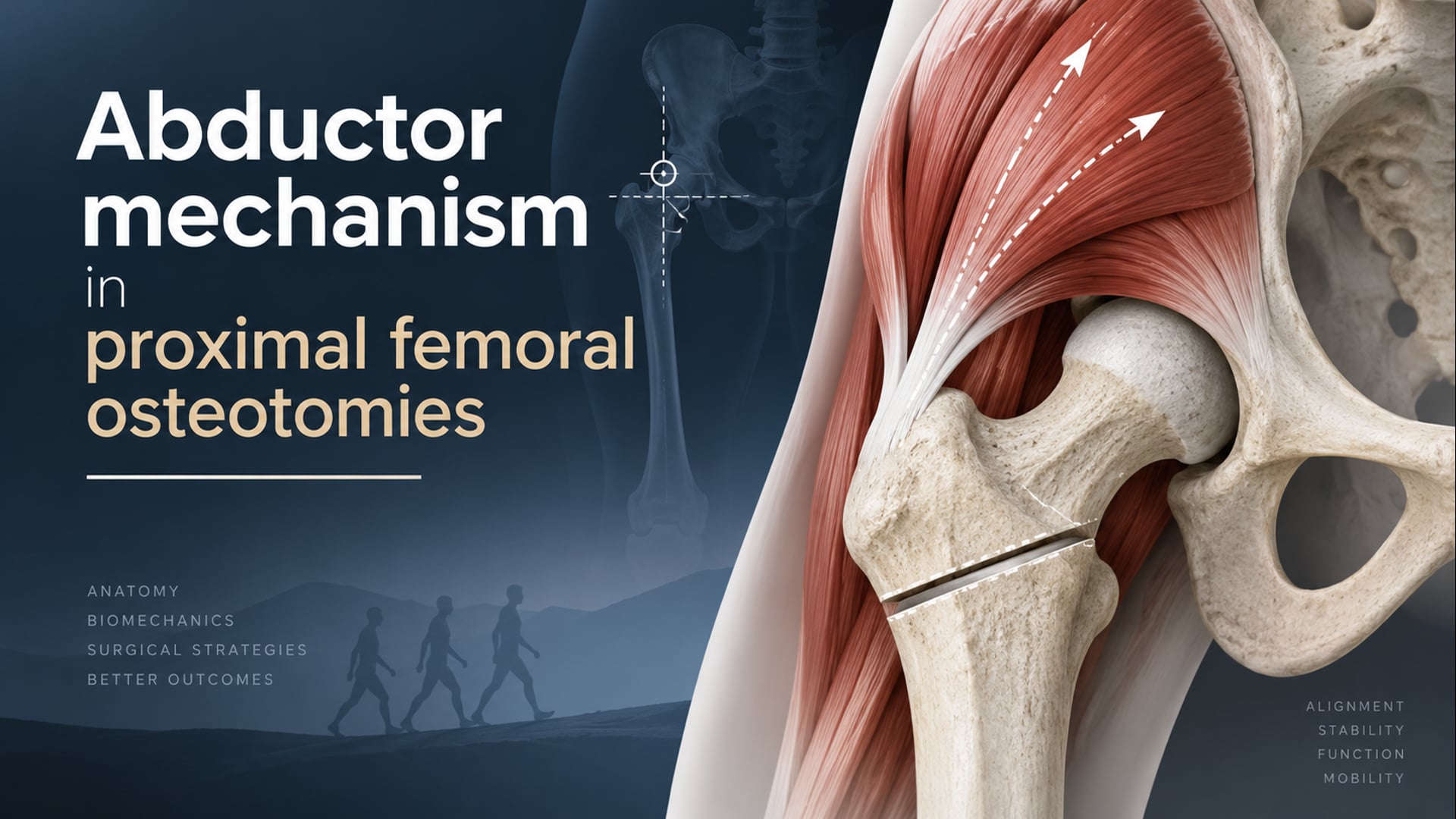 Abductor mechanism in proximal femoral osteotomies (A. Heimann)