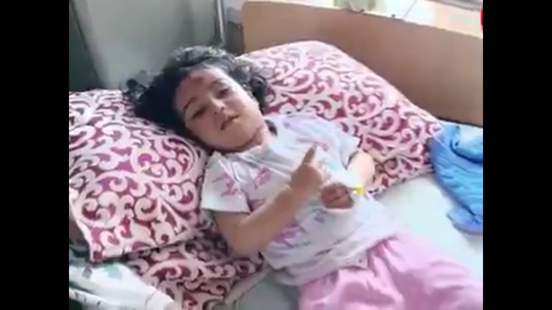 हिमाचल प्रदेश, शिमला- रुल्दूभट्ठा के शांकली क्षेत्र में करीब 20 माह की बच्ची पर आवारा कुत्तों ने हमला कर दिया, बताया