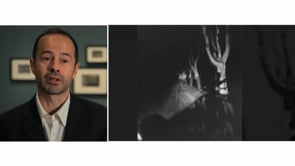 Vignette de la vidéo