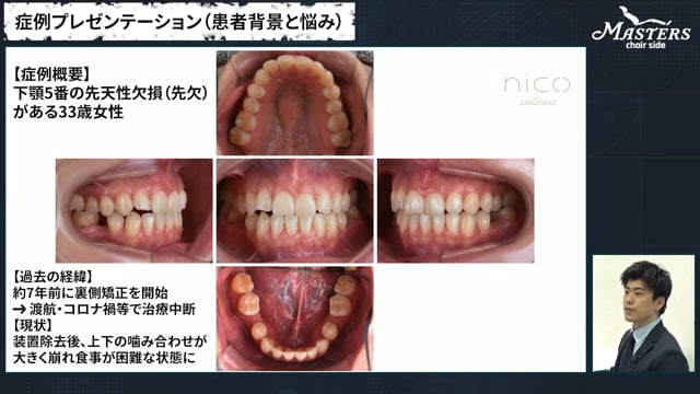 Part1 矯正症例検討