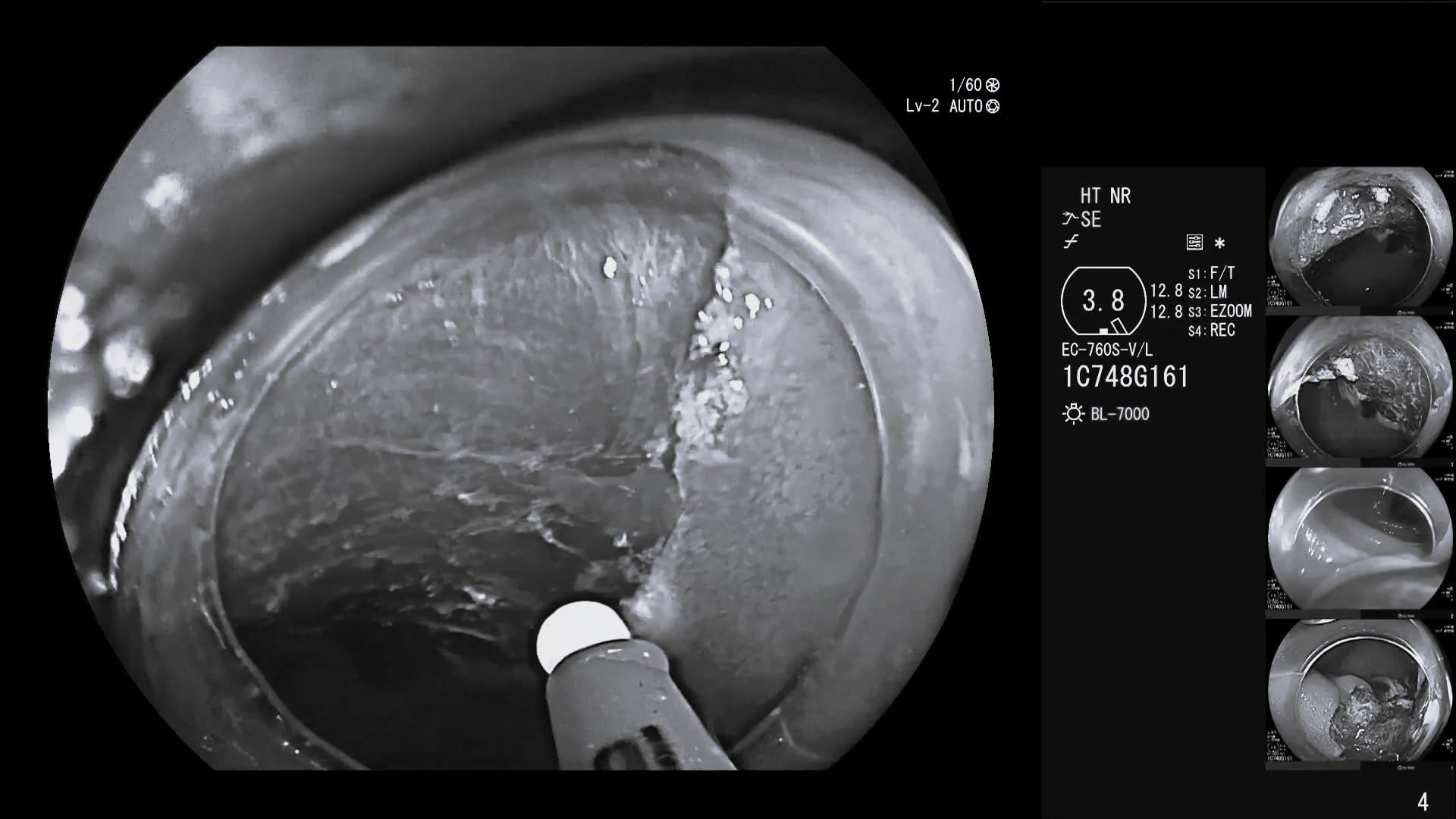 VIO® 3 preciseAPC with FiAPC® circumferential