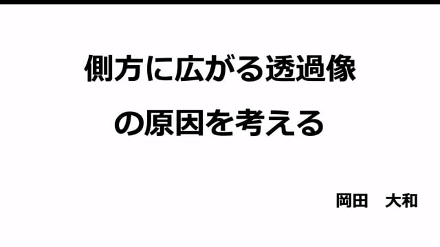 側方に広がる透過像の原因を考える｜岡田大和先生(Topics)