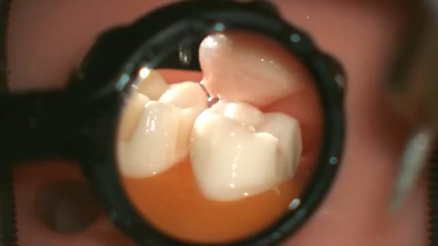 Related Embedded Video Item Thumbnail