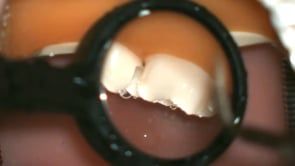 Related Embedded Video Item Thumbnail