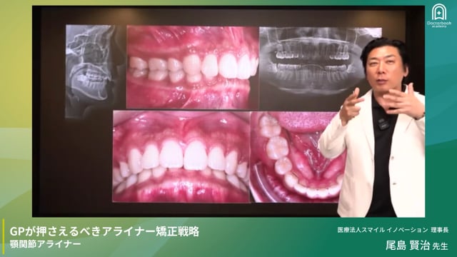 尾島賢治プレミアム講演｜GPが押さえるべきアライナー矯正戦略［全4回］ DAY4｜全顎治療の最前線"カッティングエッジ" 教育講演