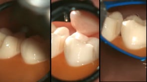 Related Embedded Video Item Thumbnail