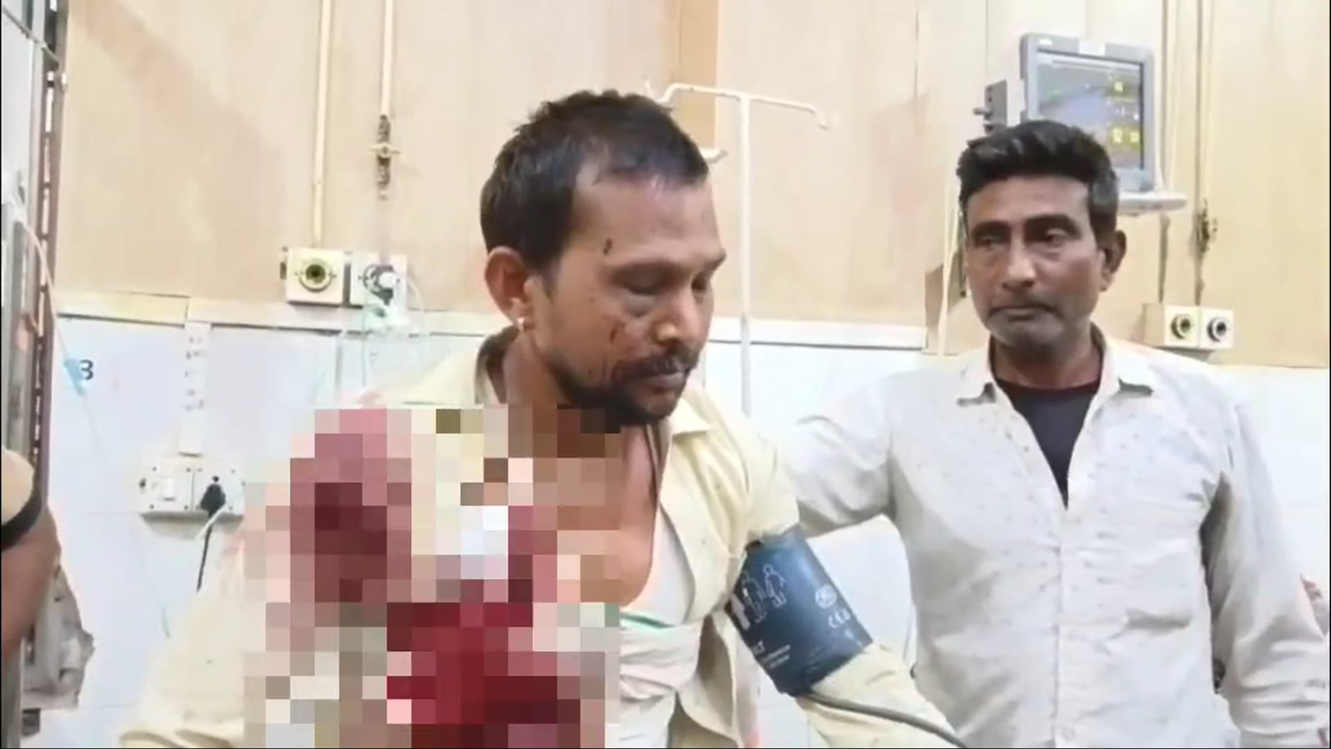 मथुरा में दबंगों के हौसले बुलंद! मामूली विवाद में युवक को मारी गोली, हालत गंभीर