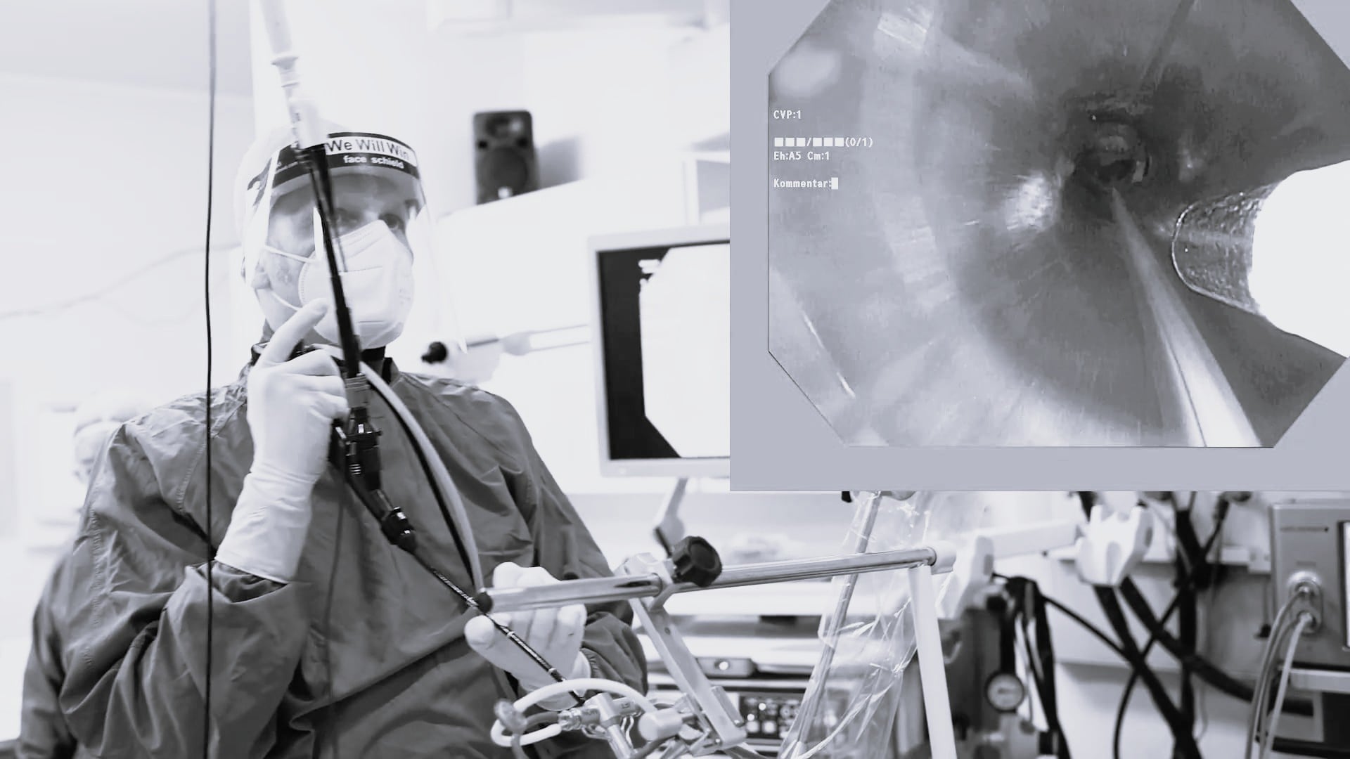 Navigated sheath cryobiopsy | 1.1mm probe