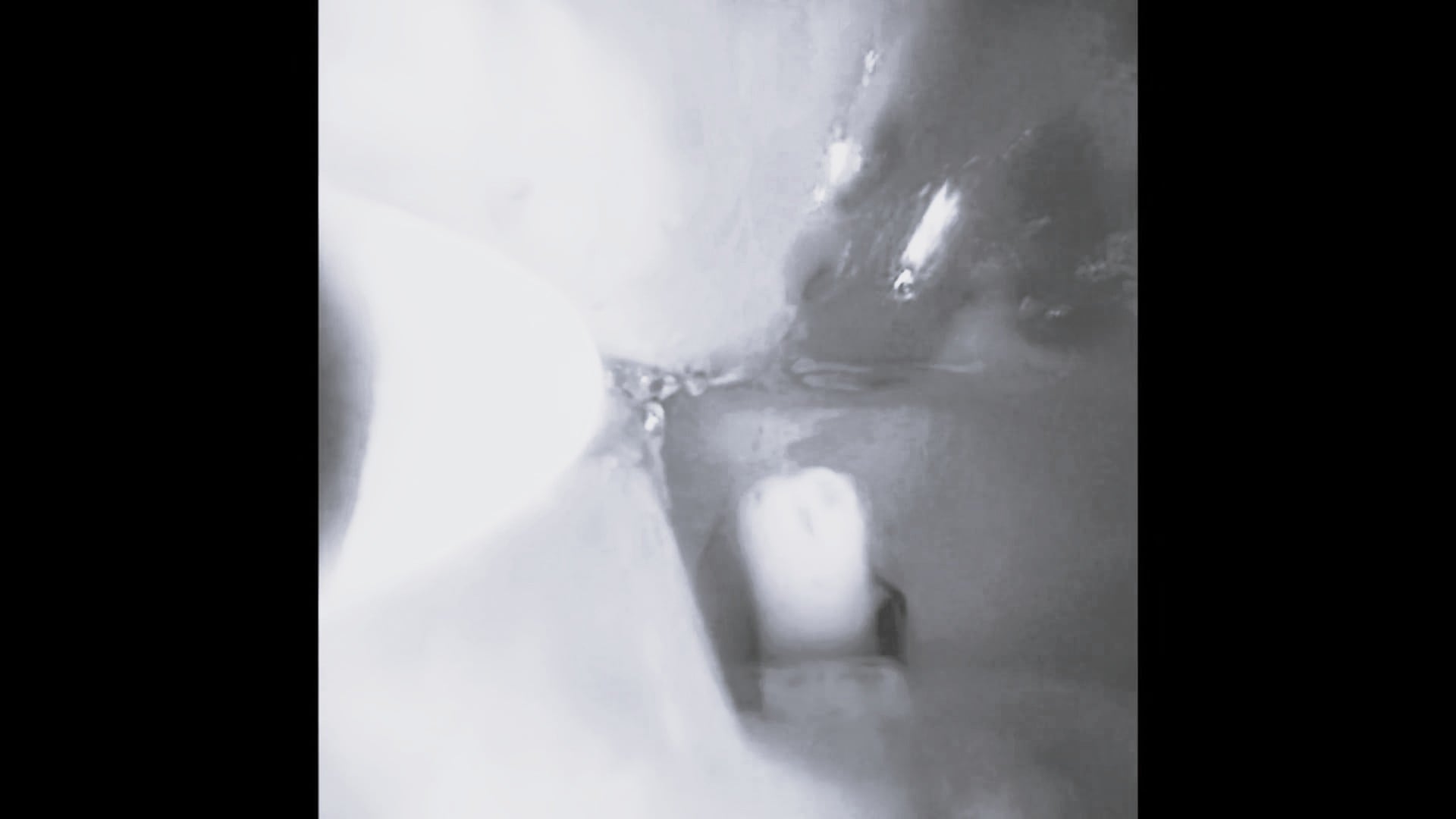 Electrosurgical Cutting and Cryodevitalization