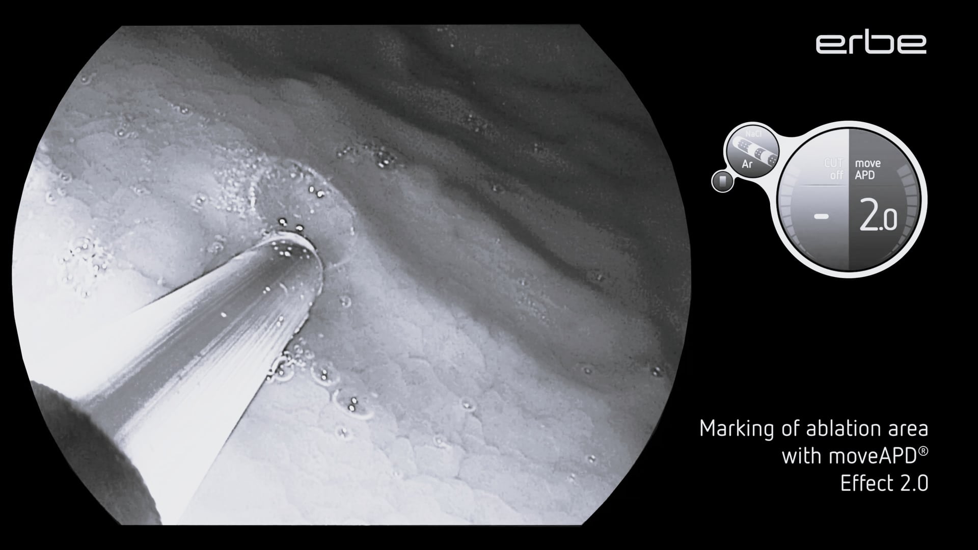 GMA of Fundus using MOVIVA® with VIO® moveAPD® Mode