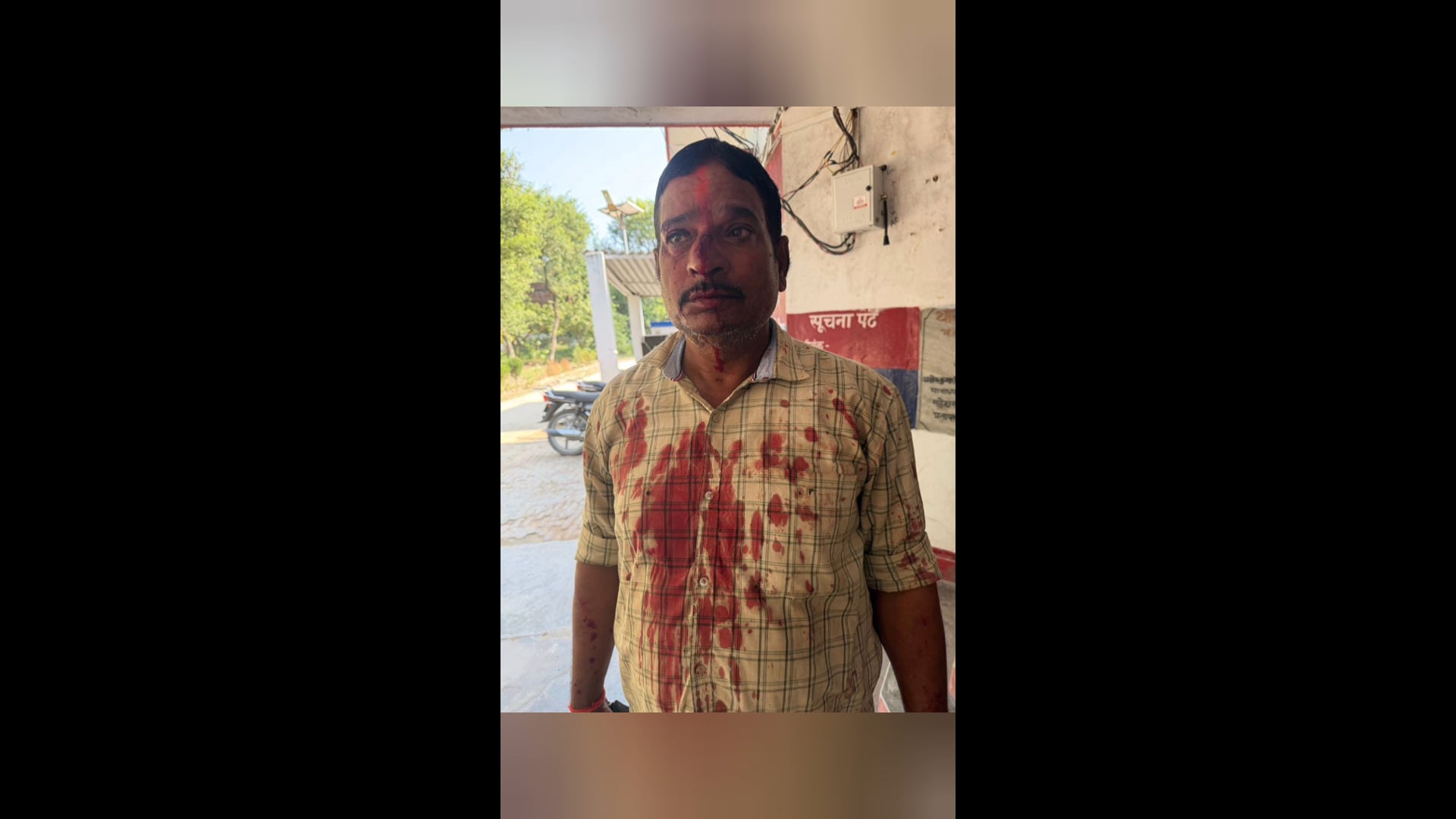 ऑडियो वायरल करने के विवाद में युवक पर हमला, लाठी-डंडों और तलवार से मारपीट कर किया घायल#latest_news 
