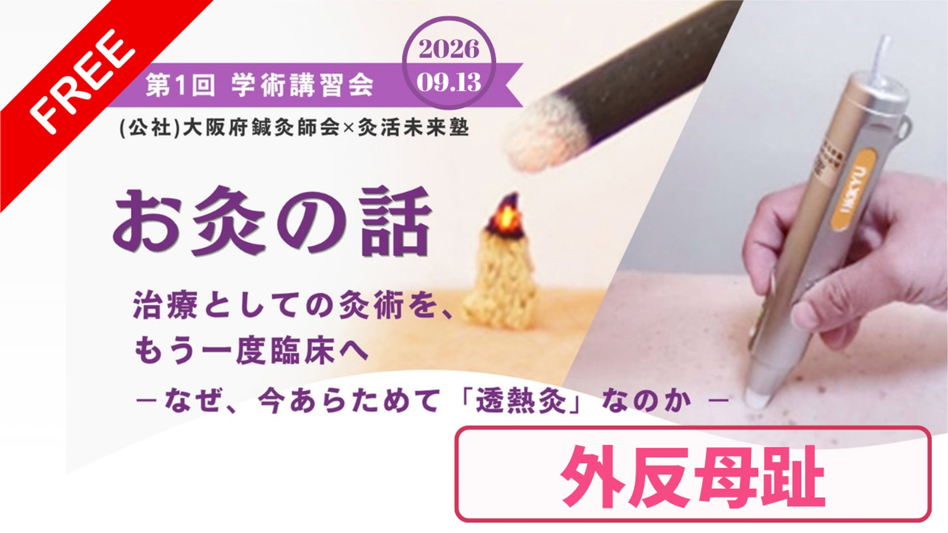 お灸の話：実技：外反母趾【大阪府鍼灸師会第１回学術講習会】2026年09月13日