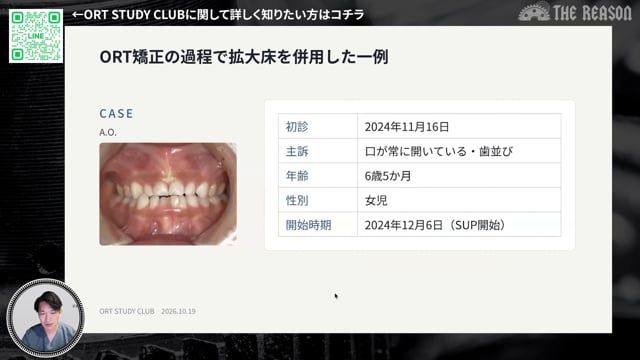 第44回 ORT矯正の過程で拡大床を併用した一例
