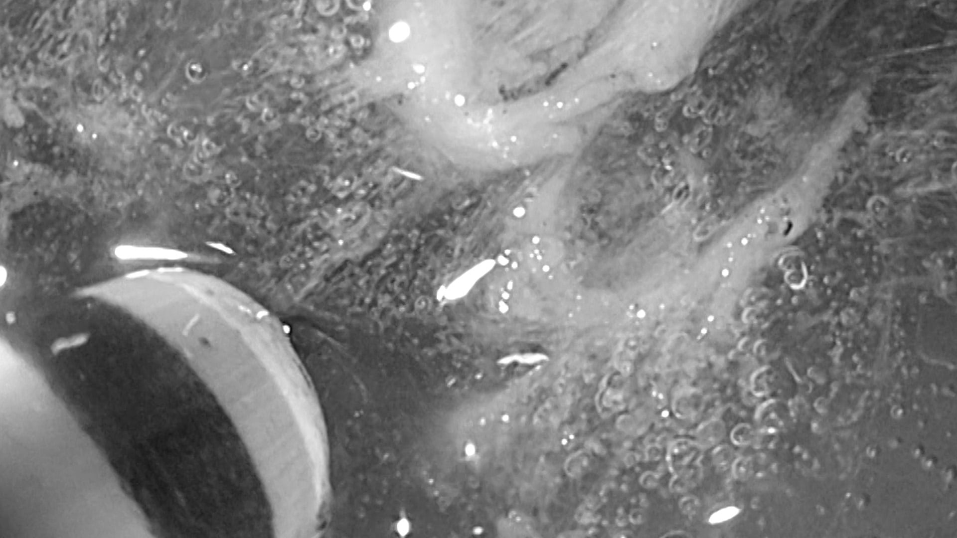 HYBIRDknife® flex - Cut and coagulate precisely