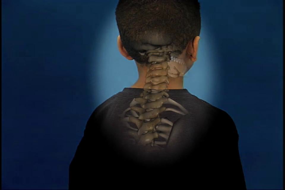 Spine Neck Animation on Vimeo